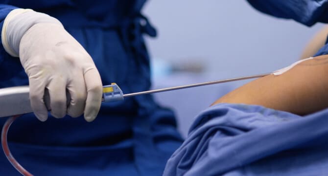 Cirugía de Fracturas